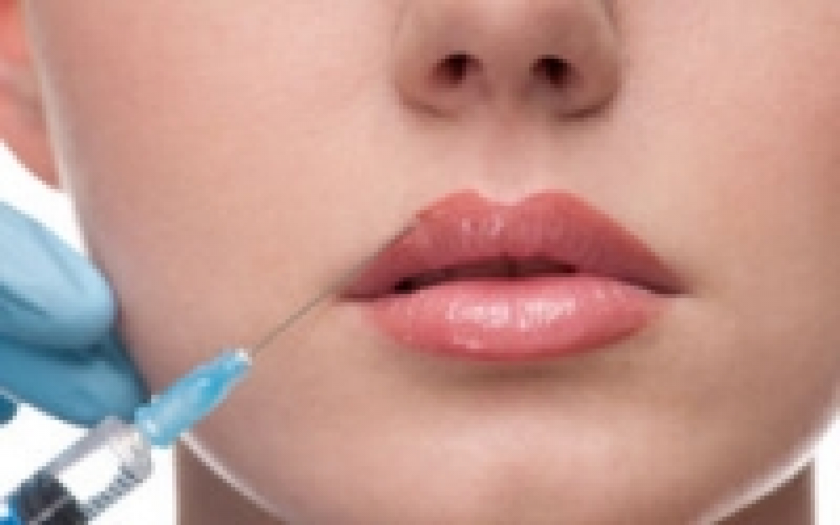Restylane